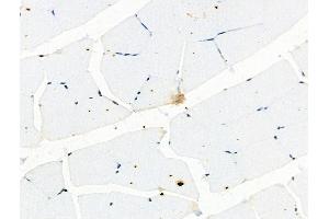 Phospho-YB1 (Ser102) Antibody at 1/100 staining Rat muscle tissue by IHC-P.