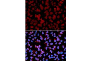 Immunofluorescence analysis of U2OS cell using TNFAIP3 antibody. (TNFAIP3 anticorps  (AA 1-190))