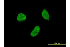 Immunofluorescence of monoclonal antibody to ZNF7 on HeLa cell.
