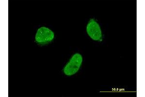 Immunofluorescence of monoclonal antibody to ZNF7 on HeLa cell. (ZNF7 anticorps  (AA 67-165))