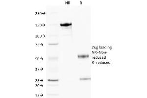 SDS-PAGE Analysis Purified Cytochrome C Mouse Monoclonal Antibody (6H2. (Cytochrome C anticorps)