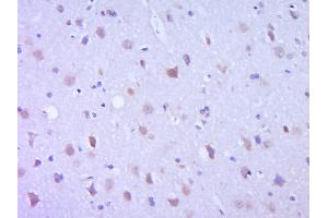 Paraformaldehyde-fixed, paraffin embedded Rat Brain Antigen retrieval by boiling in sodium citrate buffer (pH6.