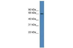 WB Suggested Anti-TBC1D19 Antibody Titration: 0.