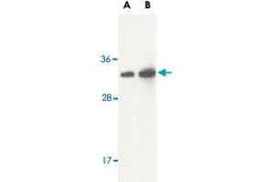 Western blot analysis of STRADB in human brain lysate with STRADB polyclonal antibody  at (A) 1 and (B) 2 ug/mL . (STRADB anticorps  (Internal Region))