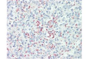 Anti-Mannose Receptor / CD206 antibody IHC staining of human spleen. (Mannose Receptor anticorps  (AA 359-388))
