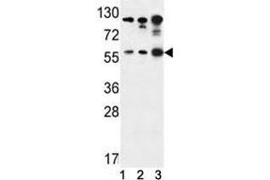 AKT1 antibody western blot analysis in (1) Jurkat, (2) A375, and (3) Y79 lysate