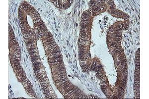 Image no. 2 for anti-Mitogen-Activated Protein Kinase Kinase 3 (MAP2K3) antibody (ABIN1499400)