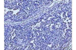 IHC analysis of MRE11 using anti-MRE11 antibody (ABIN7600025). (Mre11 anticorps  (AA 14-481))