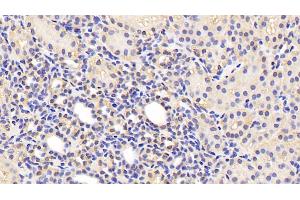 Detection of zAP70 in Human Kidney Tissue using Polyclonal Antibody to Zeta Chain Associated Protein Kinase 70 kDa (zAP70)