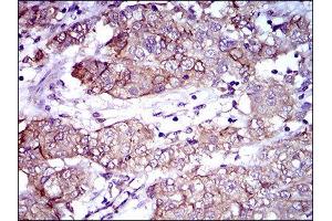 Immunohistochemistry (IHC) image for anti-Activated Leukocyte Cell Adhesion Molecule (ALCAM) (AA 48-216) antibody (ABIN1846222) (CD166 anticorps  (AA 48-216))