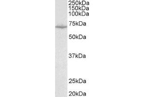 ABIN2559988 (0. (SLC6A8 anticorps  (Internal Region))
