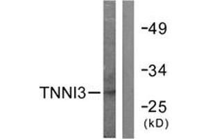 Western blot analysis of extracts from mouse heart cells, using TNNI3 (Ab-142) Antibody. (TNNI3 anticorps  (AA 111-160))