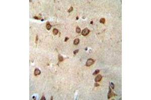 anti-Dpy-19-Like 1 (C. Elegans) (DPY19L1) (AA 560-590), (C-Term) antibody