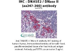 Image no. 1 for anti-Deoxyribonuclease II, Lysosomal (DNASE2) (AA 347-360) antibody (ABIN1733721) (DNASE2 anticorps  (AA 347-360))
