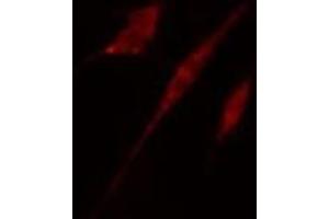 ABIN6278650 staining HT29 cells by IF/ICC. (CSNK1A1 anticorps  (pTyr294))