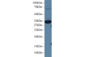 Detection of IGFBP1 in Porcine Kidney lysate using Polyclonal Antibody to Insulin Like Growth Factor Binding Protein 1 (IGFBP1)