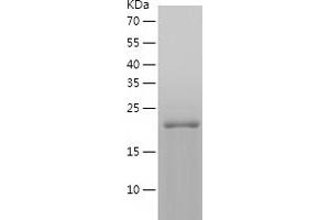 Western Blotting (WB) image for Ras Homolog Gene Family, Member A (RHOA) (AA 1-193) protein (His-IF2DI Tag) (ABIN7124784)