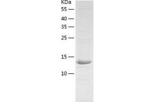 Western Blotting (WB) image for Hephaestin (HEPH) (AA 968-1124) protein (His tag) (ABIN7123315)