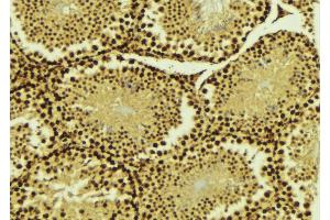 ABIN6268876 at 1/100 staining Mouse testis tissue by IHC-P. (PIAS4 anticorps  (C-Term))