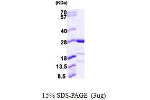 SDS-PAGE (SDS) image for Calcyphosine-Like (CAPSL) (AA 1-208) protein (His tag) (ABIN667893)