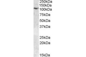 Western Blotting (WB) image for anti-Transient Receptor Potential Cation Channel, Subfamily C, Member 6 (TRPC6) (AA 918-931) antibody (ABIN490466) (TRPC6 anticorps  (AA 918-931))