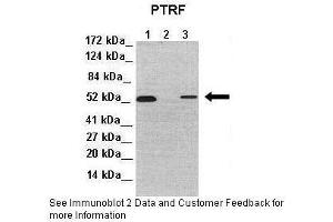 Lanes:   Lane 1: 50ug mouse embryonic fibroblast lysate Lane 2: 50ug mouse PTRF-KO embryonic fibroblast lysate Lane 3: 50ug mouse PTRF-KO embryonic fibroblast lysate+FLAG-PTRF protein  Primary Antibody Dilution:   1:1000  Secondary Antibody:   Donkey anti-Rabbit-HRP  Secondary Antibody Dilution:   1:10000  Gene Name:   PTRF  Submitted by:   Libin Liu, Boston University. (PTRF anticorps  (Middle Region))