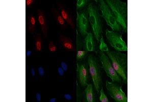 ABIN6261151 and ABIN6269196 staining  cells by IF/ICC.