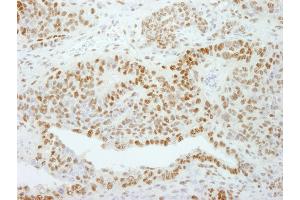 Immunohistochemistry (IHC) image for anti-General Transcription Factor III (GTF2I) (AA 985-998) antibody (ABIN7448971)