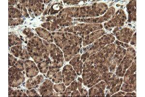 Image no. 5 for anti-serine/threonine Kinase 38 Like (STK38L) (AA 1-281) antibody (ABIN1490699)