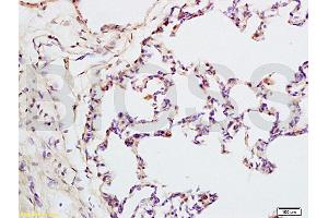 Formalin-fixed and rat lung tissue labeled with Anti-IQGAP1 Polyclonal Antibody, Unconjugated (ABIN737796) at 1:200 followed by conjugation to the secondary antibody and DAB staining (IQGAP1 anticorps  (AA 1451-1550))