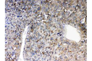 IHC analysis of MAVS using anti-MAVS antibody .