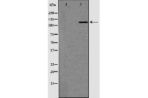 anti-DNA Repair Protein Complementing XP-G Cells (ERCC5) (N-Term) antibody