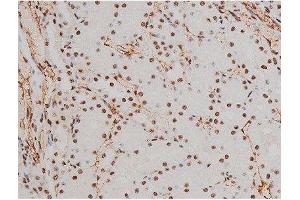 ABIN6267389 at 1/200 staining Rat kidney tissue sections by IHC-P.