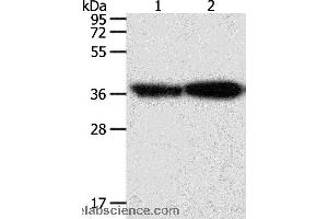 Western blot analysis of Human leiomyosarcoma and mouse testis tissue, using TPM2 Polyclonal Antibody at dilution of 1:1000 (TPM2 anticorps)