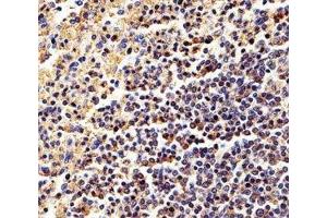 Immunohistochemical analysis of paraffin-embedded human spleen using b-Actin antibody at 1:25 dilution.