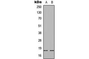 Western blot analysis of Alpha-synuclein (pS129) expression in HEK293T (A), mouse brain (B) whole cell lysates. (SNCA anticorps  (C-Term, pSer129))