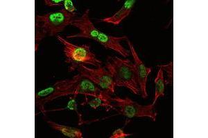 Immunofluorescence analysis of U251 cells using OTX2 mouse mAb (green). (OTX2 anticorps)