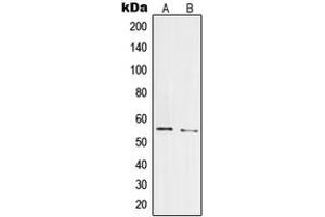 Western blot analysis of PRPF19 expression in HepG2 (A), HeLa (B) whole cell lysates. (PRP19 anticorps  (Center))