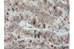 Image no. 1 for anti-Host Cell Factor C2 (HCFC2) antibody (ABIN1498601)