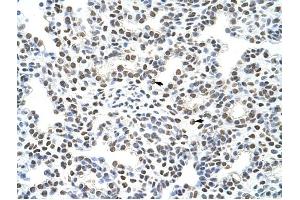 HNRPA3 antibody was used for immunohistochemistry at a concentration of 4-8 ug/ml to stain Alveolar cells (arrows) in Human Lung. (HNRNPA3 anticorps  (N-Term))