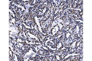 IHC analysis of TOMM70 using anti-TOMM70 antibody (ABIN7599855). (TOM70 anticorps  (AA 122-608))