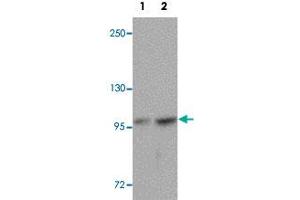 Western blot analysis of FREM2 in A-20 cell lysate with FREM2 polyclonal antibody  at (1) 0. (FREM2 anticorps  (Internal Region))