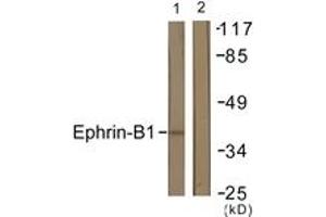 Western blot analysis of extracts from COS7 cells, using EFNB1 (Ab-317) Antibody. (Ephrin B1 anticorps  (AA 283-332))