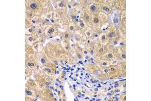 Immunohistochemistry of paraffin-embedded human liver injury using CARD11 antibody (ABIN5974295) at dilution of 1/100 (40x lens). (CARD11 anticorps)