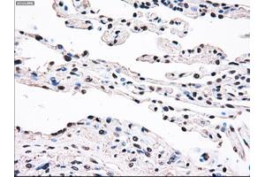 Immunohistochemical staining of paraffin-embedded prostate tissue using anti-SSBmouse monoclonal antibody. (SSB anticorps)
