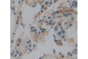IHC-P analysis of Human Tissue, with DAB staining. (PLA2G4A anticorps  (AA 1-178))