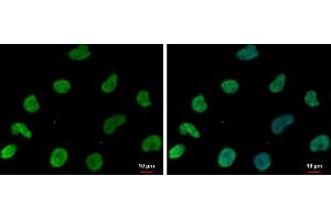 ICC/IF Image DNAJB6 antibody [N3C3] detects DNAJB6 protein at nucleus by immunofluorescent analysis.