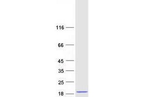 Validation with Western Blot