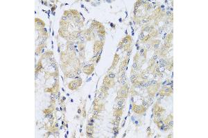 Immunohistochemistry of paraffin-embedded human stomach using FANCA antibody at dilution of 1:100 (x40 lens). (FANCA anticorps)