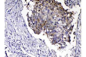 IHC analysis of Relaxin 1 using anti-Relaxin 1 antibody .
